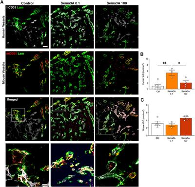 Semaphorin 3A promotes the long-term persistence of human SVF-derived microvascular networks in engineered grafts